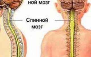 Инсульт спинного мозга симптомы первые признаки
